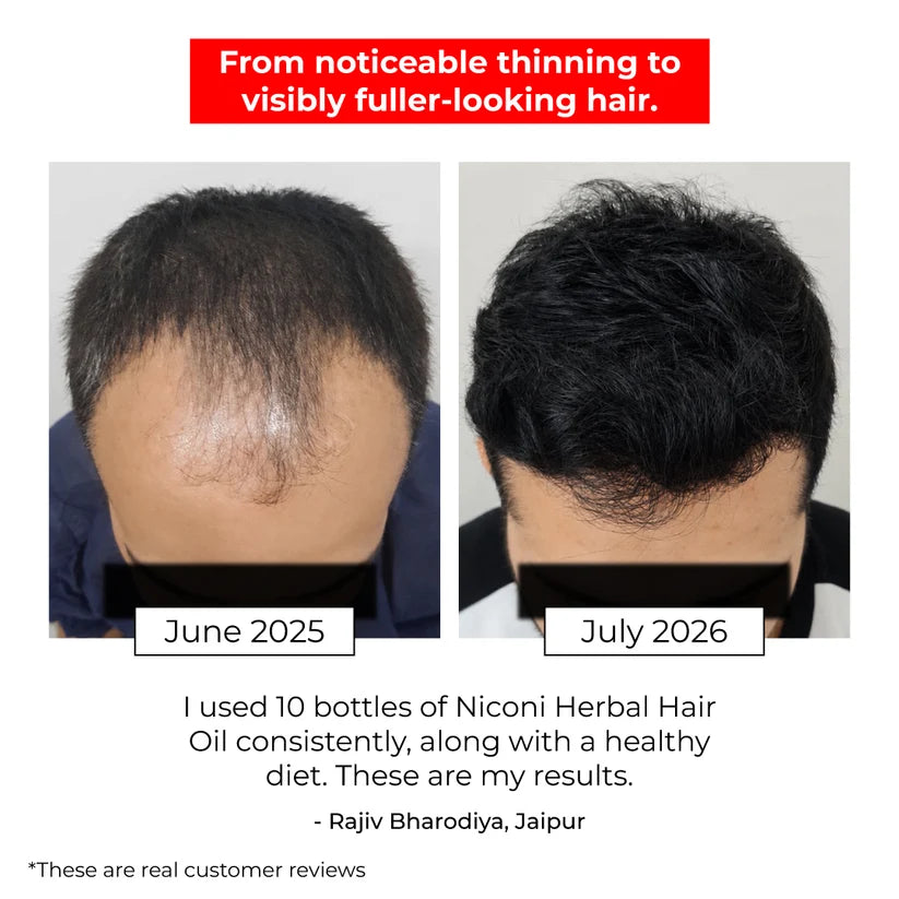 Niconi Herbal Hair Oil (Comb Applicator) 200ml